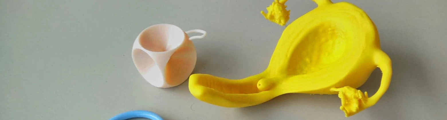 Gebruiksvriendelijk Pessarium
